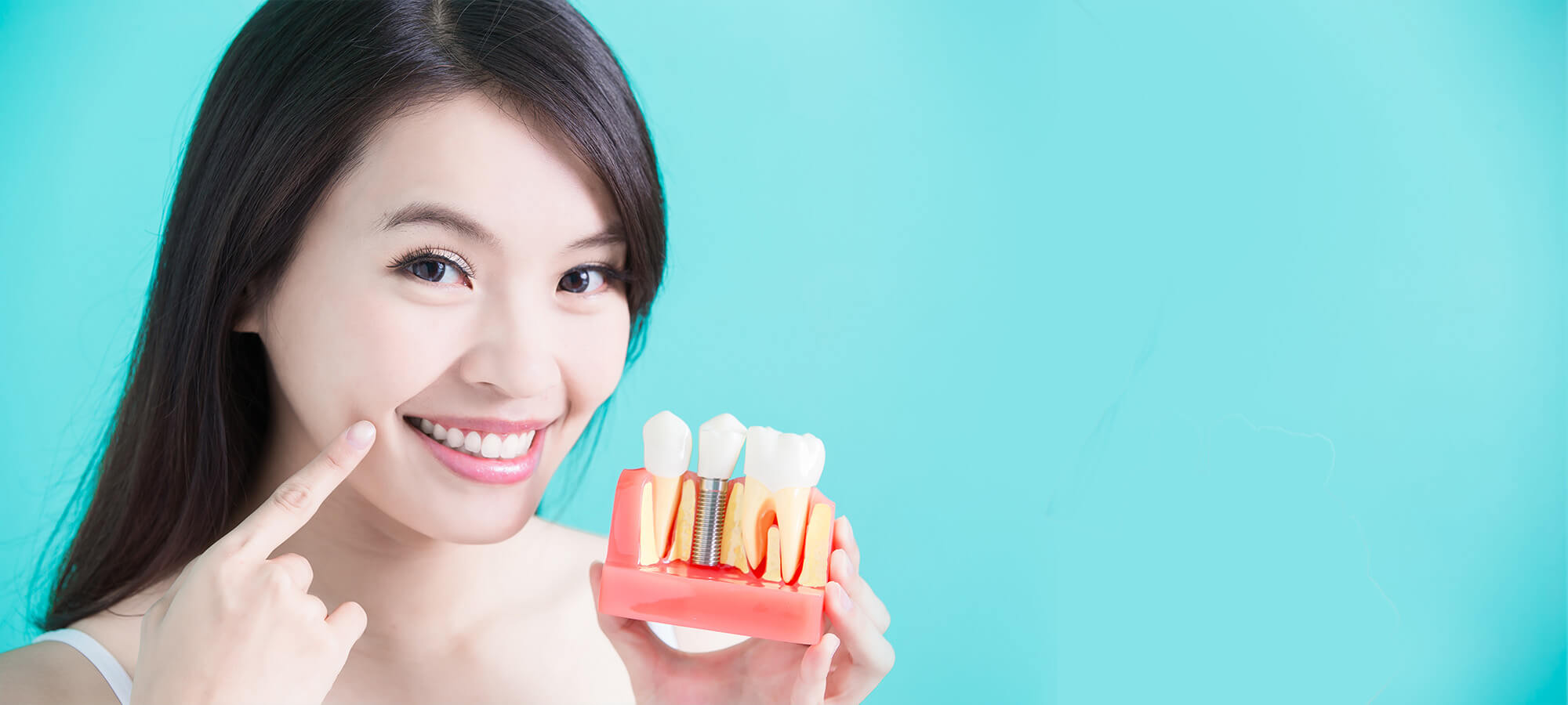 Innovation‧Reliability‧Enthusiasm in New Flower’s dental implantation